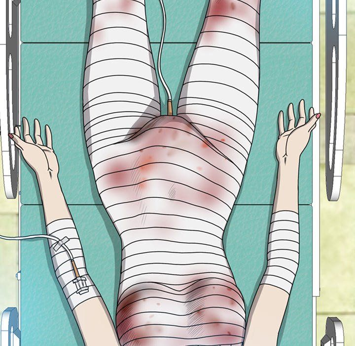 Disfigured Chapter 7 - HolyManga.Net